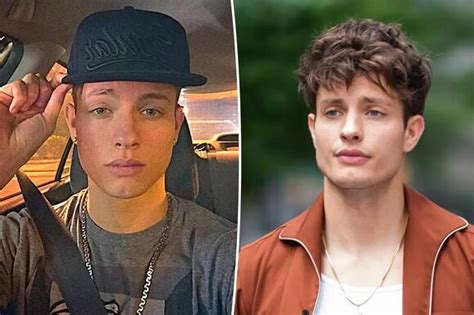 Matt Rife denies plastic surgery, explains why face changed